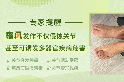 南京痛风风湿病医院在哪里？高尿酸血症与痛风如何区分与应对？