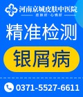 郑州牛皮癣医院银屑病检测咨询